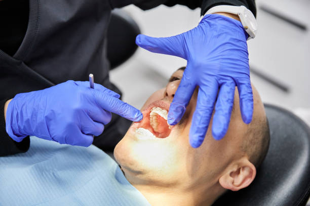 Best Dentist for Tooth Abscess  in Sturtevant, WI